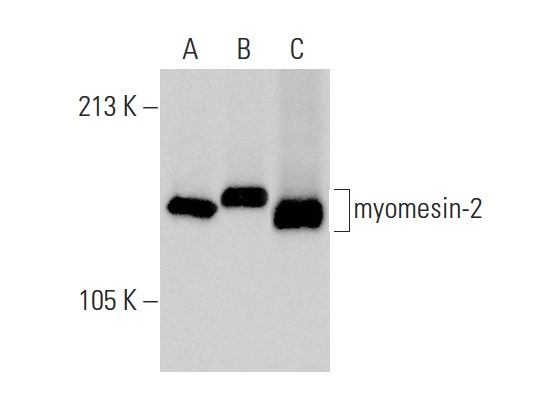 myomesin-2 (H-16): sc-30385. Western blot analysis of myomesin-2 expression in human skeletal muscle (A), mouse skeletal muscle (B) and human heart (C) tissue extracts.
