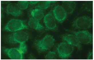 Myosin X (C-1): sc-166720. Immunofluorescence staining of methanol-fixed HeLa cells showing cytoplasmic localization.