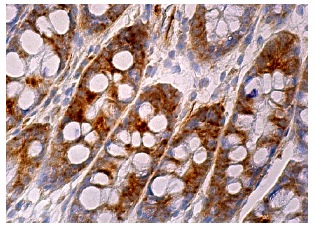 Myosin X (C-1): sc-166720. Immunoperoxidase staining of formalin fixed, paraffin-embedded human rectum tissue showing cytoplasmic staining of glandular cells.