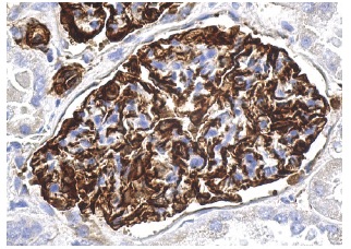 nestin (10c2): sc-23927. Immunoperoxidase staining of formalin fixed, paraffin-embedded human kidney tissue showing cytoplasmic staining of glomerular cells.