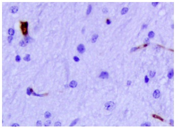 nestin (10c2): sc-23927. Nestin in mouse cerebral cortex (20X microscopic magnification). Dilution: 1:80 in dilution buffer (0.05% BSA in PBS).Blocking: 0.1% BSA in PBS at room temp. Kindly provided by Dr. Albert J. Fornace Jr., Georgetown University.