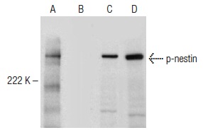 Western blot analysis of nestin phosphorylation in untreated (A,C) and lambda protein phosphatase (sc-200312A) treated (B,D) mouse embryonic brain tissue extract. Antibodies tested include p-nestin (Thr 1495): sc-33880 (A,B) and nestin (C-20): sc-21247 (C,D).