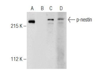 Western blot analysis of nestin phosphorylation in untreated (A,C) and lambda protein phosphatase (sc-200312A) treated (B,D) SH-SY5Y whole cell lysates. Antibodies tested include p-nestin (A-4): sc-377538 (A,B) and nestin (C-20): sc-21247 (C,D).
