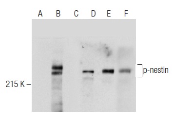 Western blot analysis of nestin phosphorylation in untreated (A,D), induction cocktail (sc-362324) treated (B,E) and induction cocktail (sc-362324) and lambda protein phosphatase (sc-200312A) treated (C,F) SH-SY5Y whole cell lysates. Antibodies tested include p-nestin (Thr 1495): sc-33880 (A,B,C) and nestin (C-20): sc-21247 (D,E,F).