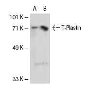 Plastin (H-300): sc-28531. Western blot analysis of T-Plastin expression in non-transfected: sc-117752 (A) and mouse T-Plastin transfected: sc-123886 (B) 293T whole cell lysates.