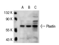 Plastin (H-300): sc-28531. Western blot analysis of Plastin expression in non-transfected: sc-117752 (A) and human Plastin transfected: sc-113519 (B) 293T whole cell lysates.
