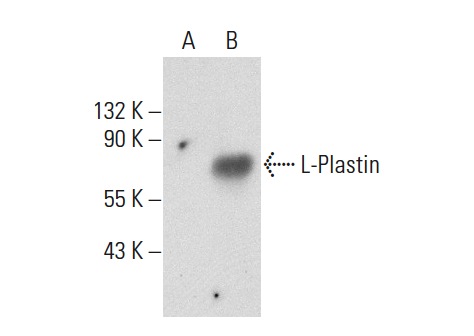 Plastin (H-300): sc-28531. Western blot analysis of L-Plastin expression in non-transfected: sc-117752 (A) and human L-Plastin transfected: sc-159508 (B) 293T whole cell lysates.