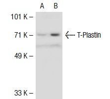 T-Plastin (C-15): sc-16655. Western blot analysis of T-Plastin expression in non-transfected: sc-117752 (A) and mouse T-Plastin transfected: sc-123886 (B) 293T whole cell lysates.