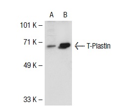 T-Plastin (C-15)-R: sc-16655-R. Western blot analysis of T-Plastin expression in non-transfected: sc-117752 (A) and mouse T-Plastin transfected: sc-123886 (B) 293T whole cell lysates.