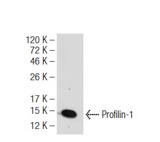 Profilin-1 (B-10): sc-137235. Western blot analysis of Profilin-1 expression in Hep G2 whole cell lysate.