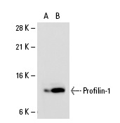 Profilin-1 (C-15): sc-30522. Western blot analysis of Profilin-1 expression in human Profilin-1 transfected: sc-111317 (A) and non-transfected: sc-110760 (B) 293 whole cell lysates.