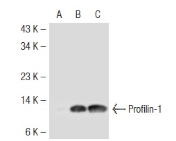 Profilin-1 (C-15): sc-30522. Western blot analysis of Profilin-1 expression in non-transfected 293T: sc-117752 (A), mouse Profilin-1 transfected 293T: sc-125858 (B) whole cell lysates and human platelet extract (C) .