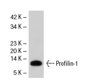 Profilin-1 (C-15): sc-30522. Western blot analysis of Profilin-1 expression in human platelet extract.