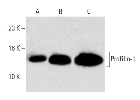 Profilin-1 (H-4): sc-137236. Western blot analysis of Profilin-1 expression in non-transfected: sc-110760 (A), human Profilin-1 transfected: sc-110512 (B) 293 whole cell lysates and human platelet extract (C).