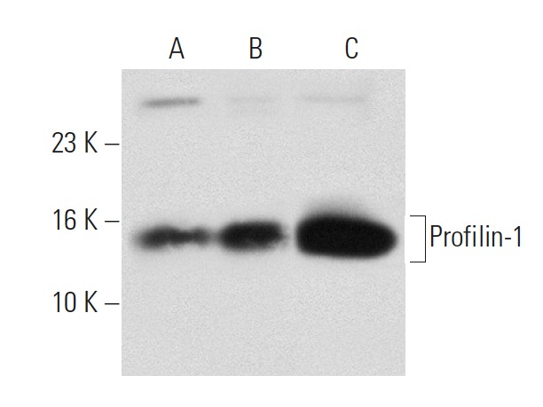 Profilin-1 (H-4): sc-137236. Western blot analysis of Profilin-1 expression in non-transfected: sc-117752 (A), mouse Profilin-1 transfected: sc-125858 (B) 293T whole cell lysates and human platelet extract (C).