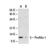 Profilin-1 (N-20): sc-18346. Western blot analysis of Profilin-1 expression in human Profilin-1 transfected: sc-111317 (A) and non-transfected: sc-110760 (B) 293 whole cell lysates.