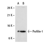 Profilin-1 (N-20): sc-18346. Western blot analysis of Profilin-1 expression in human Profilin-1 transfected: sc-111317 (A) and non-transfected: sc-110760 (B) 293 whole cell lysates.