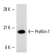 Profilin-1 (N-20): sc-18346. Western blot analysis of Profilin-1 expression in human platelet extract.