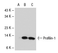 Profilin-1 (N-20): sc-18346. Western blot analysis of Profilin-1 expression in non-transfected: sc-117752 (A), mouse Profilin-1 transfected: sc-125858 (B) 293T whole cell lysates and human platelet extract (C).