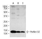 Profilin-1/2 (FL-140): sc-25788. Western blot analysis of Profilin-1/2 expression in human platelet extract (A), Hep G2 (B) and JAR (C) whole cell lysates.
