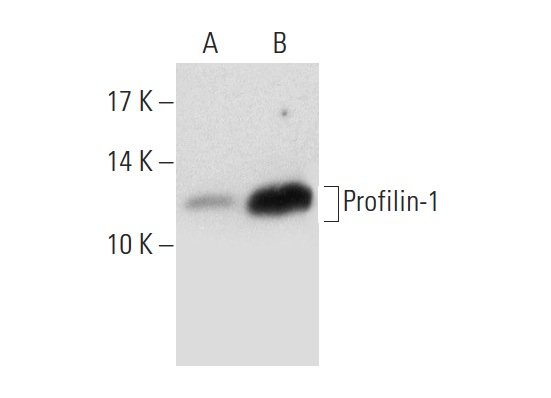 Profilin-1/2 (FL-140): sc-25788. Western blot analysis of Profilin-1 expression in non-transfected: sc-117752 (A) and mouse Profilin-1 transfected: sc-125858 (B) 293T whole cell lysates.