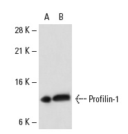 Profilin-1/2 (FL-140): sc-25788. Western blot analysis of Profilin-1 expression in non-transfected: sc-110760 (A) and human Profilin-1 transfected: sc-110512 (B) 293 whole cell lysates.