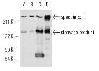 spectrin α II (C-3): sc-48382. Western blot analysis of spectrin α II expression in HS68 (A) and TF-1 (B) whole cell lysates and mouse uterus (C) and rat brain (D) tissue extracts. Note the presence of cleavage product.
