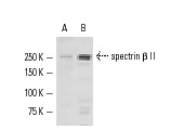 spectrin β II (H-125): sc-28272. Western blot analysis of spectrin β II expression in rat brain tissue extract (A) and HeLa nuclear extract (B).