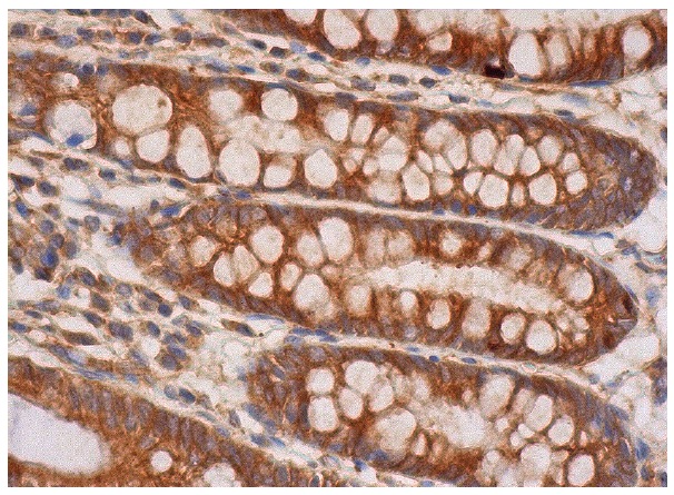 spectrin β II (H-125): sc-28272. Immunoperoxidase staining of formalin fixed, paraffin-embedded human rectum tissue showing cytoplasmic staining of glandular cells.