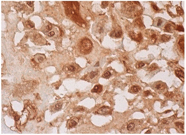 spectrin β IV (C-16): sc-131788. Immunoperoxidase staining of formalin fixed, paraffin-embedded human placenta tissue showing nuclear and cytoplasmic staining of decidual cells.