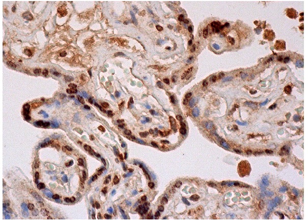 spectrin b IV (C-16): sc-131788. Immunoperoxidase staining of formalin fixed, paraffin-embedded human placenta tissue showing nuclear and cytoplasmic staining of trophoblastic cells.