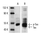 Western blot detection of Tau phosphorylation in mouse brain extracts (A,B). Blots were probed with p-Tau (Ser 404): sc-12952 (A) and Tau (C-17): sc-1995 (B).