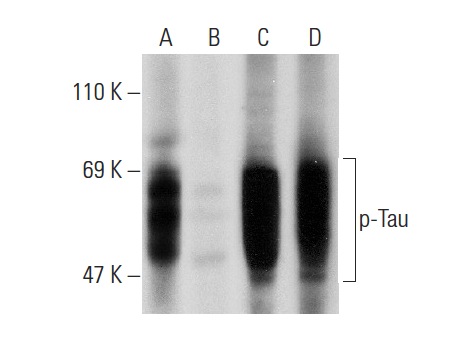 Western blot analysis of Tau phosphorylation in untreated (A,C) and lambda protein phosphatase (sc-200312A) treated (B,D) rat brain tissue extracts. Antibodies tested include p-Tau (Ser 515/516)-R: sc-16923-R (A,B) and Tau (C-17): sc-1995 (C,D).