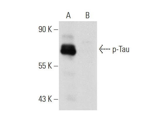 p-Tau (Ser 396)-R: sc-12414-R. Western blot analysis of Tau phosphorylation in untreated (A) and lambda protein phosphatase (sc-200312A) treated (B) mouse brain tissue extracts.
