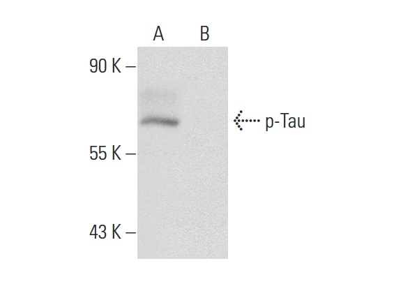 p-Tau (Ser 396)-R: sc-12414-R. Western blot analysis of Tau phosphorylation in untreated (A) and lambda protein phosphatase treated (B) SK-N-SH whole cell lysates.