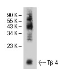 Tβ-4 (FL-44): sc-67114. Western blot analysis of Tβ-4 expression in rat heart tissue extract.