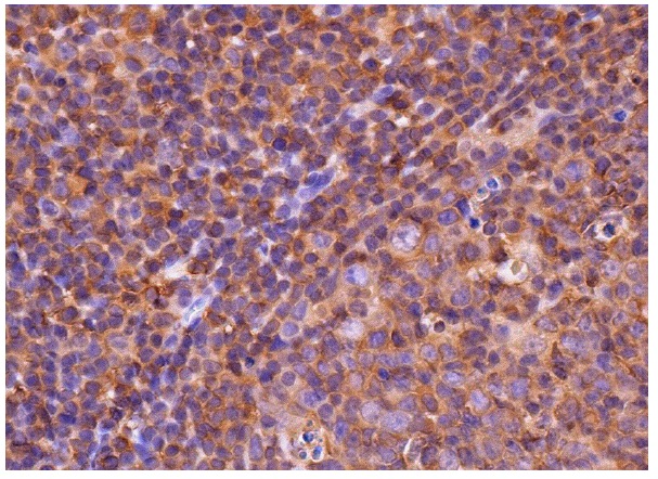 Tβ-4 (FL-44): sc-67114. Immunoperoxidase staining of formalin fixed, paraffin-embedded human tonsil tissue showing cytoplasmic staining of cells in germinal and non-germinal centers.