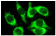 TCP-1 α (P-15): sc-13869. Immunofluorescence staining of methanol-fixed HeLa cells showing cytoplasmic staining.