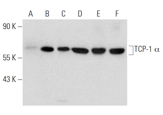 TCP-1 α (P-15): sc-13869. Western blot analysis of TCP-1 α expression in non-transfected 293T: sc-117752 (A), mouse TCP-1 α transfected 293T: sc-123956 (B), HeLa (C) and F9 (D) whole cell lysates and rat testis (E) and mouse testis (F) tissue extracts.