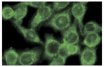 TCP-1 β (H-80): sc-28556. Immunofluorescence staining of methanol-fixed HeLa cells showing cytoplasmic localization.