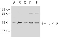 TCP-1 β (H-80): sc-28556. Western blot analysis of TCP-1 β expression in mouse testis tissue extract (A) and ZR-75-1 (B), F9 (C), HeLa (D) and HOS (E) whole cell lysates.