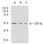 TCP-1 β (H-80): 28556. Western blot analysis of TCP-1 β expression in mouse testis tissue extract (A) and HeLa (B) and ZR-75-1 (C) whole cell lysates.