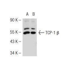 TCP-1 β (H-80): sc-28556. Western blot analysis of TCP-1 β expression in non-transfected: sc-117752 (A) and mouse TCP-1 β transfected: sc-123955 (B) 293T whole cell lysates.