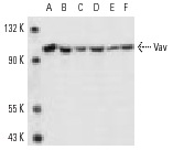 Vav (H-211): sc-7206. Western blot analysis of Vav expression in Jurkat (A), MOLT-4 (B), CTLL-2 (C), HL-60 (D), GM-CSF-treated K-562 (E) and CCRF-CEM (F) whole cell lysates.