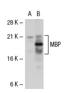 MBP (C-16)-R: sc-13914-R. Western blot analysis of MBP expression in non-transfected: sc-117752 (A) and mouse MBP transfected: sc-121552 (B) 293T whole cell lysates.