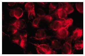 MBP (D-18): sc-13912. Immunofluorescence staining of methanol-fixed HeLa cells showing membrane localization.
