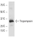 Tropomyosin (FL-284): sc-28543. Western blot analysis of Tropomyosin expression in rat skeletal muscle tissue extract.