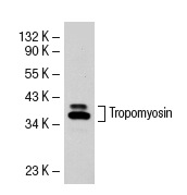 Tropomyosin (FL-284): sc-28543. Western blot analysis of Tropomyosin expression in Sol8 whole cell lysate.