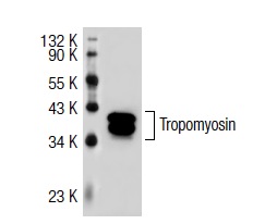 Tropomyosin (FL-284): sc-28543. Western blot analysis of Tropomyosin expression in CCD-1064Sk whole cell lysate.
