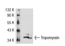 Tropomyosin (FL-284): sc-28543. Western blot analysis of Tropomyosin expression in Sol8 whole cell lysate.